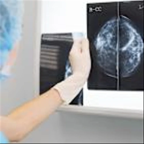ESMO 2025: Sichuan-Kelun moves in breast cancer ADC space