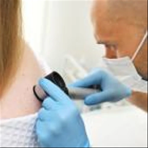 IO Biotech’s melanoma treatment trial to continue after IDMC review