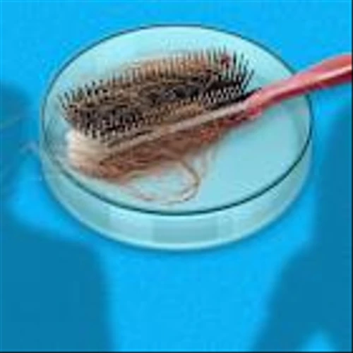 For the first time in decades, new hair-loss treatments are in the works. Here’s how they’re different.