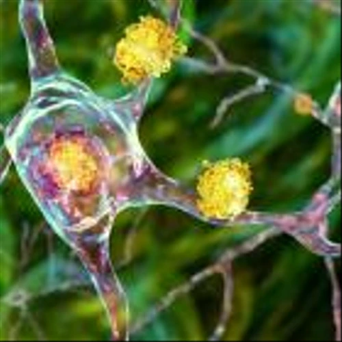 Sage ends dalzanemdor development following Phase II trial failure