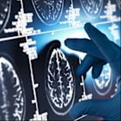 Eli Lilly and Biogen/Eisai’s extension trials make waves in Alzheimer’s market