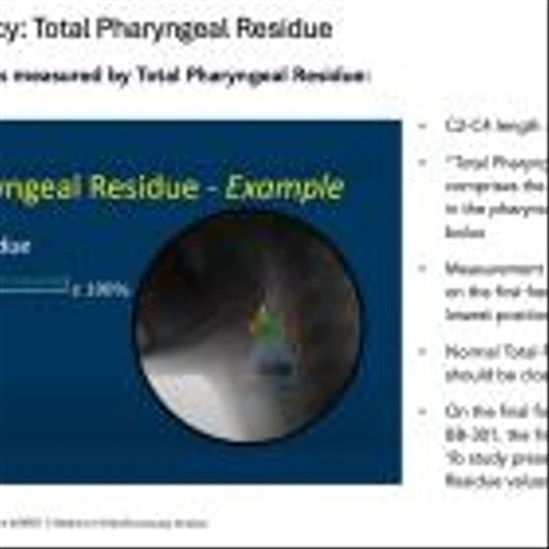 Benitec Biopharma Reports Continued Durable Improvements in the Radiographic Assessments of Swallowing Efficiency and the Subject-Reported Outcome Instrument at the 180-Day Timepoint for First OPMD Subject Treated with Low-Dose BB-301 in Phase 1b/2a Study
