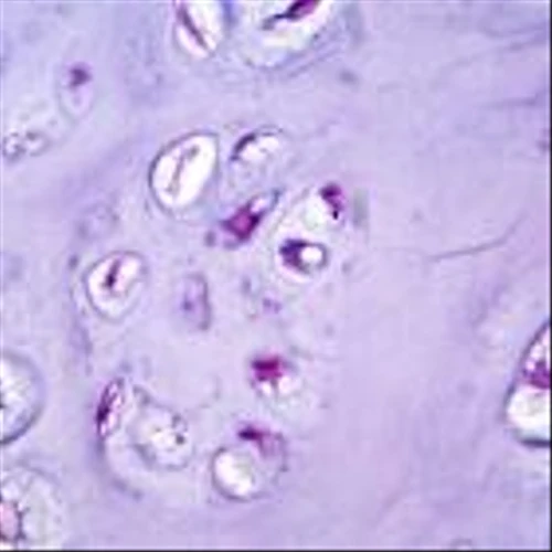 Inhibrx Biosciences’ stock soars on chondrosarcoma Phase II victory