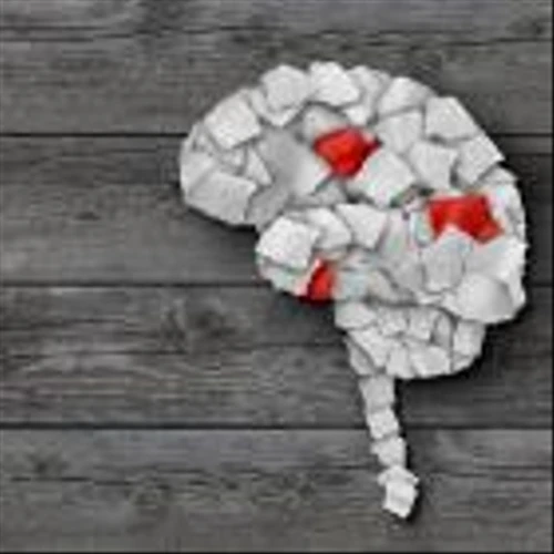 Ipsen outlines $461m for ex-US rights to Day One’s glioma therapy