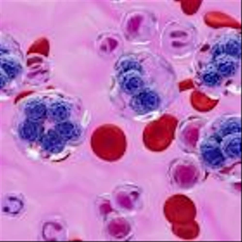 Citius Oncology and Uniphar sign European distribution deal for Lymphir