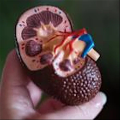 Is Vertex Pharmaceuticals Incorporated (VRTX) A Good Stock To Buy Now?