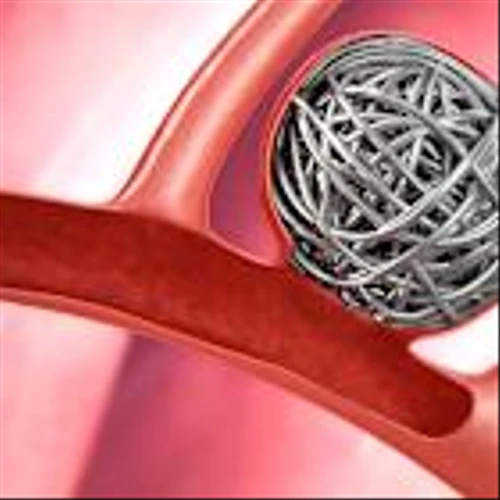 Boston Scientific Will Buy Penumbra In $14.5 Billion Medtech Deal