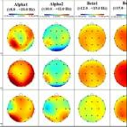 Lipocine Announces Positive Oral Brexanolone Quantitative EEG Results