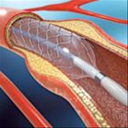 Merit Medical Expands GI Portfolio With $22M C2 CryoBalloon Acquisition