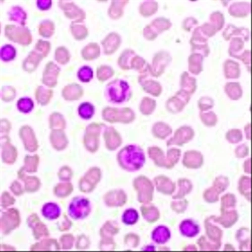 Eli Lilly eyes SoC status as Jaypirca proves superior to Imbruvica in CLL/SLL
