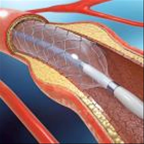 3 Medical Instruments Stocks Winning Big With GenAI Amid Global Gloom
