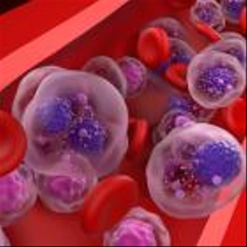Kite and Arcellx prepare to launch Phase III multiple myeloma trial