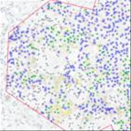 Ibex Medical Analytics Announces IVDR Certification for HER2 Biomarker Scoring Solution in Breast Cancer