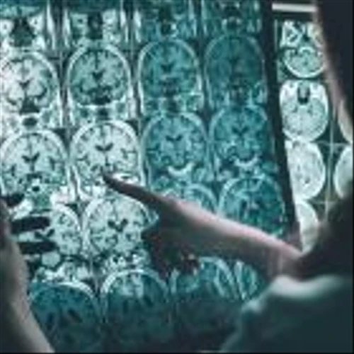 Awareness of Brain Health is Growing, but Many Are Too Afraid to Seek Help, Parade/Cleveland Clinic Survey Finds