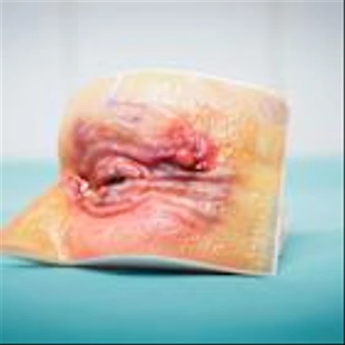 Stratasys Digital Anatomy™ Technology Powers First 3D-Printed Eyelid Surgery Training Models in Europe