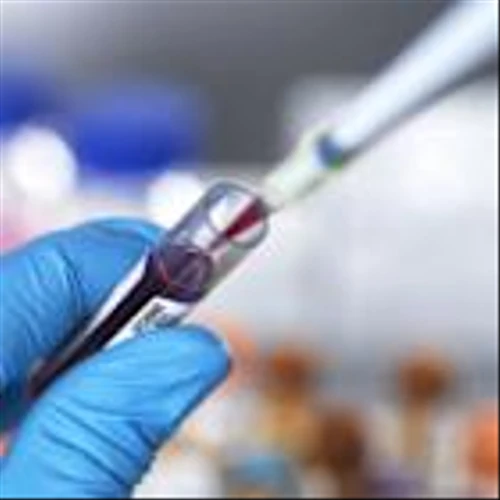 Labcorp Launches Molecular Residual Disease and Liquid Biopsy Solutions