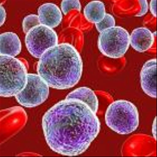 Rigel enrols first participant in Phase Ib/II AML treatment regimen trial