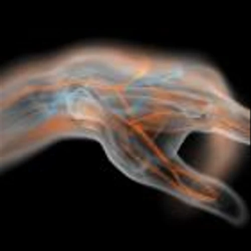 ‘It’s Spare Parts for People’: Blood Vessels Grown in a Lab