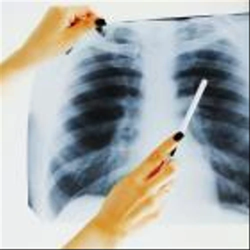 BDSX Stock Rises After Publication of Study Data for Nodify CDT Test