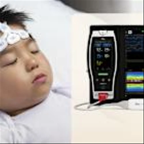 New Study Finds Masimo SedLine® Brain Function Monitoring Offers Significant Advantages During Pediatric Anesthesia