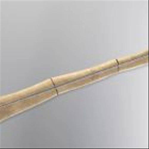 Orthofix Announces FDA 510(k) Clearance for the Rodeo Telescopic Nail