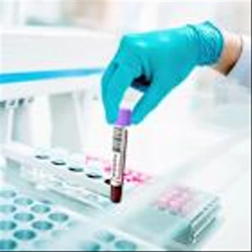 How A Broad Sell-Off Rattled Top 3% Breakout Stock Ligand Pharma