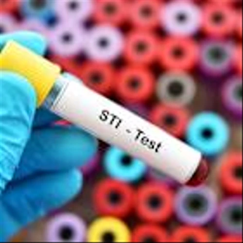US hospital STI testing sales drop amid “multifactorial” causes