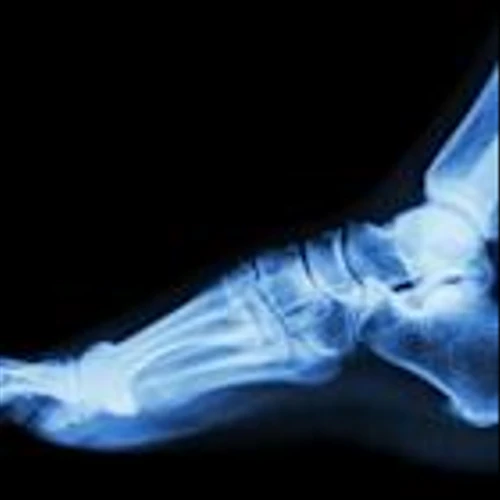 Zimmer launches 2 devices from $1.1B orthopedic takeover
