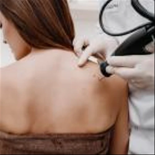 10 Botox Alternatives for Smoothing Wrinkles and Anti-Aging Treatment