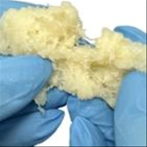 Xtant Medical Launches Trivium™ Advanced Bone Graft for Superior Performance