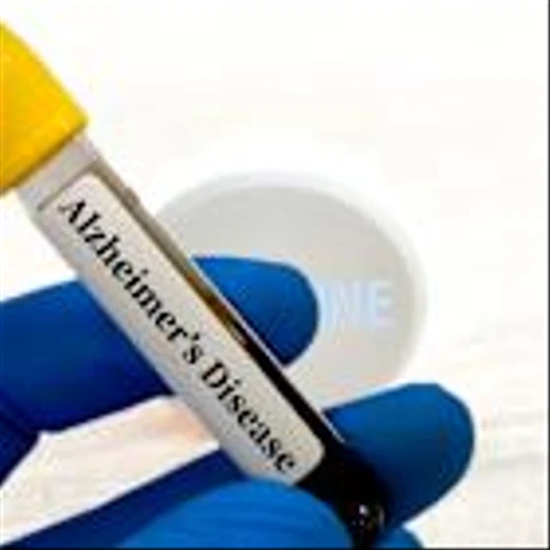 Roche’s Elecsys pTau181 test gains CE Mark to rule out Alzheimer’s