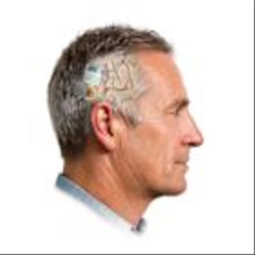 Nia Therapeutics Publishes Peer-Reviewed Validation of a 60-Channel Brain Implant for Closed-Loop Neurostimulation