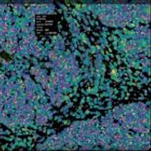 Bruker Spatial Biology Pushes Boundaries in Spatial Biology and Multiomics at AACR 2025