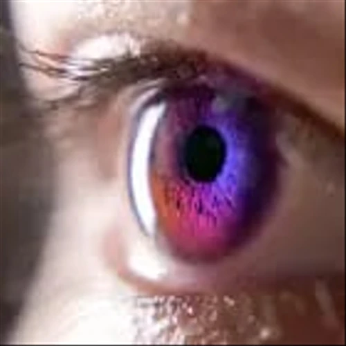 Can Ocugen succeed where other gene therapy makers have struggled?