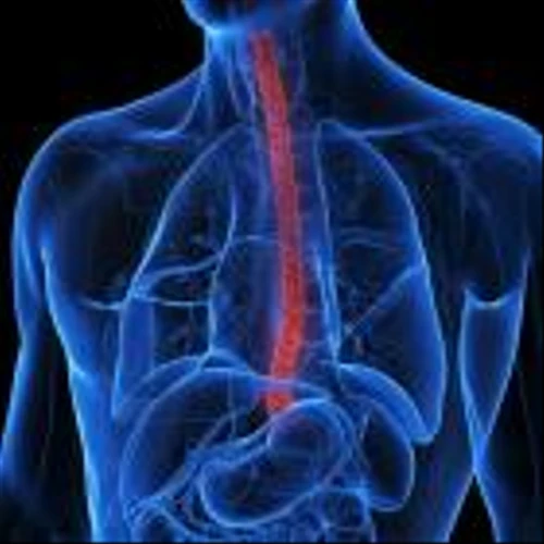 Castle Biosciences gains New York state approval for Barrett’s oesophagus test