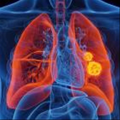Cullinan Therapeutics announces success for zipalertinib as combo therapy