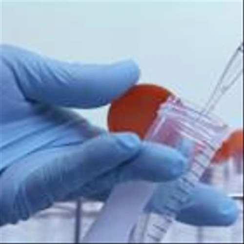 Zacks Industry Outlook Highlights Boston Scientific, Insulet, BioLife Solutions and Allurion